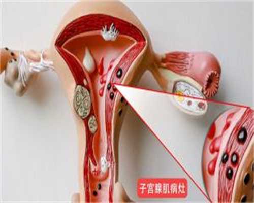 去景德镇做试管得花多钱？景德镇能做试管婴儿吗？