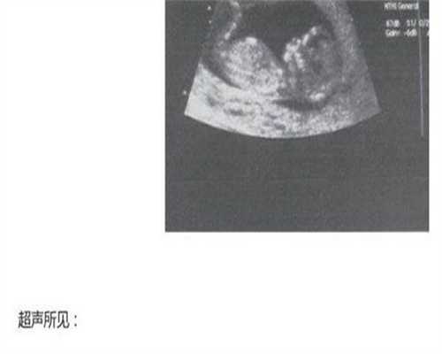 代生孩子费用：促黄体生成素高怎么降？ 促黄体生成素在卵泡期1.99是怎么回事？