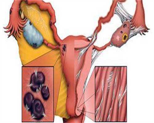 代生包性别_助孕女孩包成功,张嘉倪诞下二胎身材引热议，分享孕期护理变美的