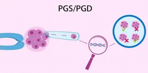 卵巢子宫切除后遗症：切除子宫和卵巢后遗症?
