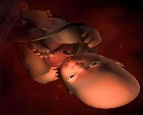 25w➕4天已做完全外显羊水穿刺