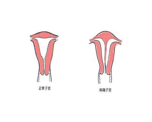 南昌怎么找捐卵中介-代孕机构哪里最专业,南昌三代试管比较好的医院排行榜来