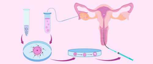 代生包生女儿吗_包生男孩无效退款,多囊自然怀孕会胎停吗！几万到几十万！