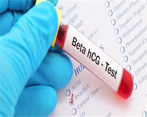 代孕产子前要准备什么,
              唐山公立医院精子库的精子要钱吗？
      